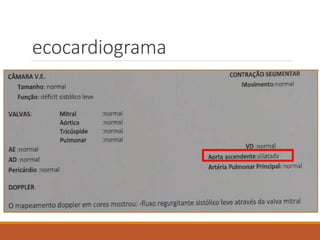ecocardiograma
 