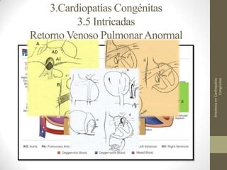 Conservative Rashkind Bas Anestesia en cardiopatías congénitas | PPTX