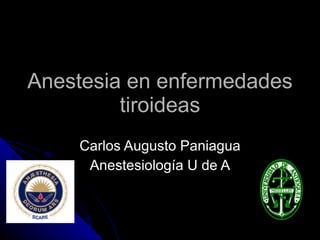 Anestesia en enfermedades tiroideas Carlos Augusto Paniagua Anestesiología U de A 