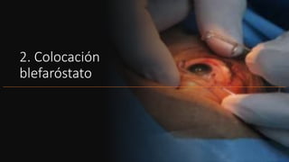 anestesia en oftalmologia.pptx
