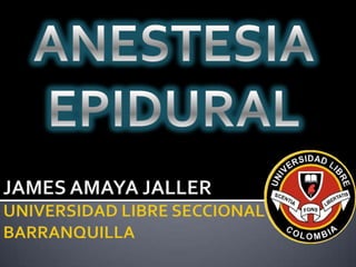 ANESTESIA EPIDURAL JAMES AMAYA JALLERUNIVERSIDAD LIBRE SECCIONAL BARRANQUILLA 