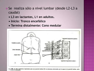  Se

realiza sólo a nivel lumbar (desde L2-L3 a
caudal)




L3 en lactantes, L1 en adultos.
Inicio: Tronco encefálico
Termina distalmente: Cono medular

 