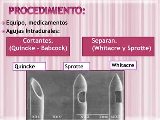  Equipo,

medicamentos
 Agujas Intradurales:

Cortantes.
(Quincke – Babcock)
Quincke

Sprotte

Separan.
(Whitacre y Sprotte)
Whitacre

 