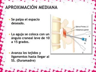 

Se palpa el espacio
deseado.



La aguja se coloca con un
ángulo craneal leve de 10
a 15 grados.



Avanza los tejidos y
ligamentos hasta llegar al
SS. (Duramadre)

 