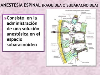  Consiste

en la
administración
de una solución
anestésica en el
espacio
subaracnoídeo

 