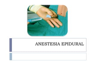 ANESTESIA EPIDURAL

 