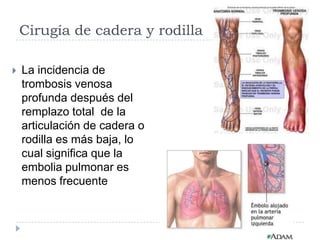 Cirugía de cadera y rodilla


La incidencia de
trombosis venosa
profunda después del
remplazo total de la
articulación de cadera o
rodilla es más baja, lo
cual significa que la
embolia pulmonar es
menos frecuente

 