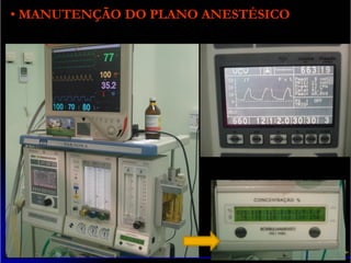• MANUTENÇÃO DO PLANO ANESTÉSICO
 
