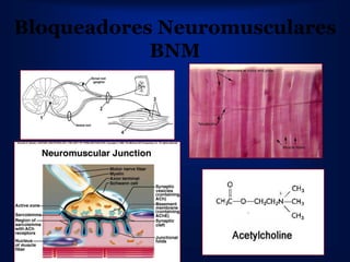 Bloqueadores Neuromusculares
            BNM
 