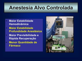 Anestesia Alvo Controlada

• Maior Estabilidade
  Hemodinâmica
• Maior Estabilidade
  Profundidade Anestésica
• Maior Previsibilidade e
  Rápida Recuperação
• Menor Quantidade de
  Fármaco
 