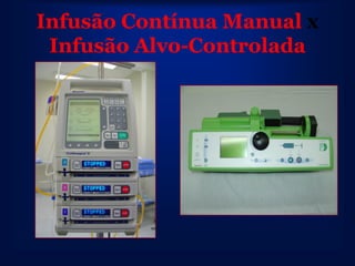 Infusão Contínua Manual x
 Infusão Alvo-Controlada
 