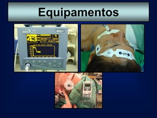 Equipamentos
 Equipamentos
 
