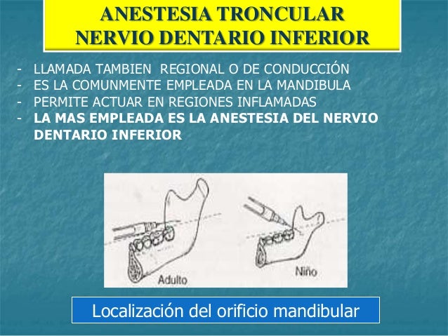 Anestesia local dr ausejo