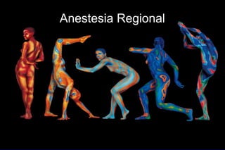Anestesia Regional
 