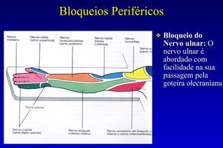 Bloqueios Periféricos
❖ Bloqueio do
Nervo ulnar: O
nervo ulnar é
abordado com
facilidade na sua
passagem pela
goteira olecraniana
 