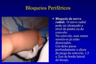 Bloqueios Periféricos
❖ Bloqueio do nervo
radial: O nervo radial
pode ser alcançado a
nível do punho ou do
cotovelo.
No cotovelo, seus ramos
sensitivos já estão
dissociados.
Um deles passa
profundamente a altura
da prega do cotovelo, 1,5
a 2cm da borda lateral
do bíceps.
 