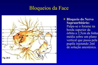 Bloqueios da Face
❖ Bloqueio do Nervo
Supraorbitário:
Palpa-se o forame na
borda superior da
órbita a 2,5cm da linha
média sobre um plano
vertical que passa pela
pupila injetando 2ml
de solução anestésica.
 