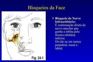 Bloqueios da Face
❖ Bloqueio do Nervo
Infraorbitário:
É continuação direta do
nervo maxilar que
ganha a órbita pela
fissura orbitária
inferior.
Divide-se em ramos
palpebral, nasal e
labial.
 