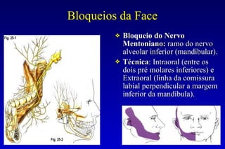Bloqueios da Face
❖ Bloqueio do Nervo
Mentoniano: ramo do nervo
alveolar inferior (mandibular).
❖ Técnica: Intraoral (entre os
dois pré molares inferiores) e
Extraoral (linha da comissura
labial perpendicular a margem
inferior da mandíbula).
 