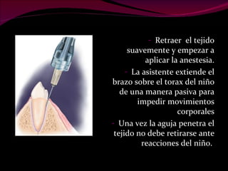 Retraer  el tejido suavemente y empezar a aplicar la anestesia. La asistente extiende el brazo sobre el torax del niño de una manera pasiva para impedir movimientos corporales Una vez la aguja penetra el tejido no debe retirarse ante reacciones del niño.  