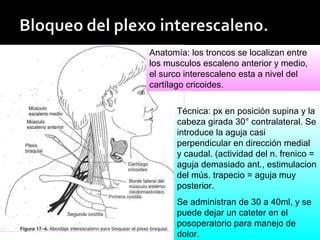 Anatomía: los troncos se localizan entre
los musculos escaleno anterior y medio,
el surco interescaleno esta a nivel del
cartílago cricoides.
Técnica: px en posición supina y la
cabeza girada 30° contralateral. Se
introduce la aguja casi
perpendicular en dirección medial
y caudal. (actividad del n. frenico =
aguja demasiado ant., estimulacion
del mús. trapecio = aguja muy
posterior.
Se administran de 30 a 40ml, y se
puede dejar un cateter en el
posoperatorio para manejo de
dolor.
 