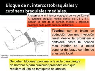Anatomía: el n. intercostobraquial deriva de T2 y el
n. cutaneo braquial medial deriva de C8 y T1.
inervan la piel de la porción medial y proximal
posterior de la parte superior del brazo.
Técnica: con el brazo en
abducción con una inyección
lineal desde la prominencia
deltoidea hasta la porción
mas inferior de la mitad
superior del brazo con 5ml de
anestesia local.
Se deben bloquear proximal a la axila para cirugía
de hombro o para cualquier procedimiento que
requiera el uso de torniquete neumático.
 