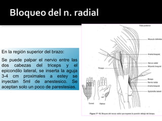 En la región superior del brazo:
Se puede palpar el nervio entre las
dos cabezas del triceps y el
epicondilo lateral, se inserta la aguja
3-4 cm proximales a estey se
inyectan 5ml de anestesico. Se
aceptan solo un poco de parestesias.
 