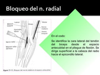 En el codo:
Se identifica la cara lateral del tendón
del biceps desde el espacio
antecubital en el pliegue de flexión. Se
dirige superficial a la cabeza del radio
hacia el epicondilo lateral.
 