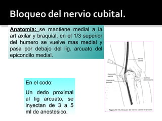 Anatomía: se mantiene medial a la
art axilar y braquial, en el 1/3 superior
del humero se vuelve mas medial y
pasa por debajo del lig. arcuato del
epicondilo medial.
En el codo:
Un dedo proximal
al lig arcuato, se
inyectan de 3 a 5
ml de anestesico.
 