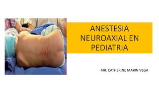 ANESTESIA
NEUROAXIAL EN
PEDIATRIA
MR. CATHERINE MARIN VEGA
 