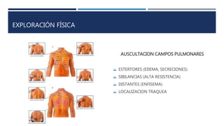 EXPLORACIÓN FÍSICA 
AUSCULTACION CAMPOS PULMONARES 
 ESTERTORES (EDEMA, SECRECIONES) 
 SIBILANCIAS (ALTA RESISTENCIA) 
 DISTANTES (ENFISEMA) 
 LOCALIZACION TRAQUEA 
 