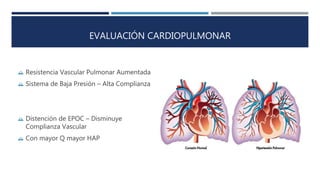 EVALUACIÓN CARDIOPULMONAR 
 Resistencia Vascular Pulmonar Aumentada 
 Sistema de Baja Presión – Alta Complianza 
 Distención de EPOC – Disminuye 
Complianza Vascular 
 Con mayor Q mayor HAP 
 