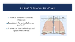 PRUEBAS DE FUNCIÓN PULMONAR 
Pruebas en Pulmón Dividido 
(Bloquear) 
Pruebas de Perfusión Pulmonar 
(133Xe IV) 
Pruebas de Ventilación Regional 
(gases radioactivos 
 