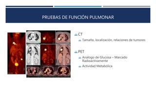 PRUEBAS DE FUNCIÓN PULMONAR 
CT 
 Tamaño, localización, relaciones de tumores 
PET 
 Análogo de Glucosa – Marcado 
Radioactivamente 
 Actividad Metabólica 
 