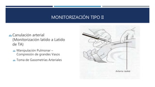 MONITORIZACIÓN TIPO II 
Canulación arterial 
(Monitorización latido a Latido 
de TA) 
 Manipulación Pulmonar – 
Compresión de grandes Vasos 
 Toma de Gasometrías Arteriales 
 