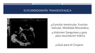 ECOCARDIOGRAFÍA TRANSESOFAGICA 
Función Ventricular, Función 
Valvular, Motilidad Miocárdica, 
Volumen Sanguíneo y guía 
para resucitación hídrica 
Guía para el Cirujano 
 
