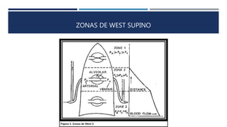 ZONAS DE WEST SUPINO 
 