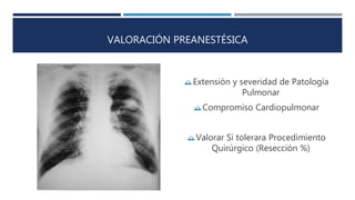 VALORACIÓN PREANESTÉSICA 
Extensión y severidad de Patología 
Pulmonar 
Compromiso Cardiopulmonar 
Valorar Si tolerara Procedimiento 
Quirúrgico (Resección %) 
 