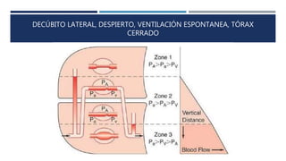 DECÚBITO LATERAL, DESPIERTO, VENTILACIÓN ESPONTANEA, TÓRAX 
CERRADO 
 