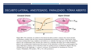 DECUBITO LATERAL, ANESTESIADO, PARALIZADO , TÓRAX ABIERTO 
 