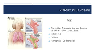 HISTORIA DEL PACIENTE 
TOS 
 Bronquitis – Tos productiva, por 3 meses 
del año en 2 años consecutivos. 
 Irritabilidad 
 Cultivos 
 Hemoptisis – Ca (bronquial) 
 