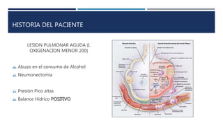 HISTORIA DEL PACIENTE 
LESION PULMONAR AGUDA (I. 
OXIGENACION MENOR 200) 
 Abuso en el consumo de Alcohol 
 Neumonectomia 
 Presión Pico altas 
 Balance Hídrico POSITIVO 
 