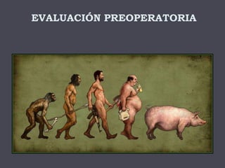 EVALUACIÓN PREOPERATORIA
 