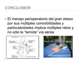 CONCLUSIÓN


   El manejo perioperatorio del gran obeso
    por sus múltiples comorbilidades y
    particularidades implica múltiples retos y
    no sólo la “temida” vía aérea
 
