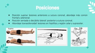 ● Posición supina: lesiones anteriores a sutura coronal, abordaje más común
frontal y pterional.
● Posición sentada o decúbito lateral: posterior a sutura coronal.
● Abordaje transesfenoidal: lesiones en hipófisis y región celar y supracelar.
Posiciones
 