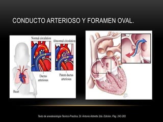 Epiglotis estrecha, plana