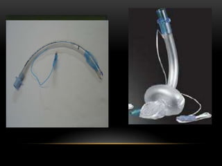 FaringePredictores:Mallampatti