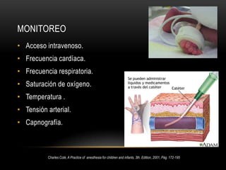 LenguaprominenteTexto de anestesiología Teorico-Practica, Dr. Antonio Aldrette 2da. Edición, Pág. 1086-1087  