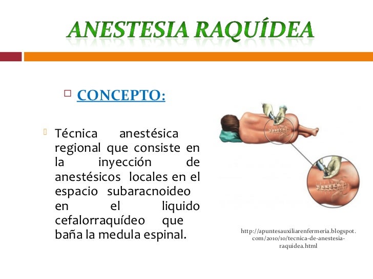 Anestesia Espinal O Raquidea Pdf