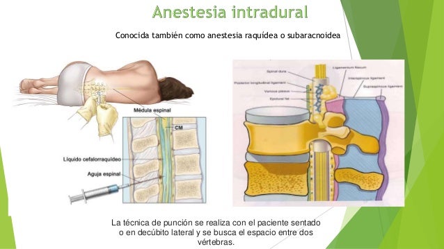 Anestesia Regional Anestesiologia - 